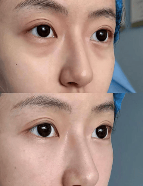 央视推荐护眼品牌集体亮相第一名无悬念九游会网址是多少叶黄素含量TOP盘点(图6)