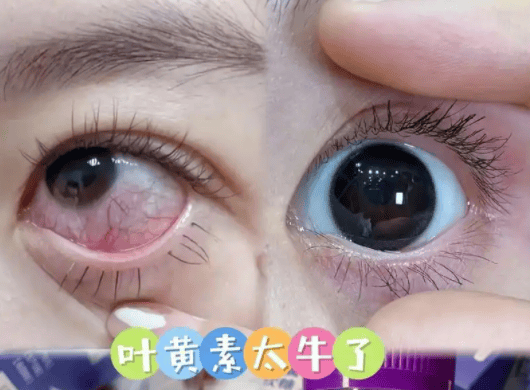 央视推荐护眼品牌集体亮相第一名无悬念九游会网址是多少叶黄素含量TOP盘点(图13)